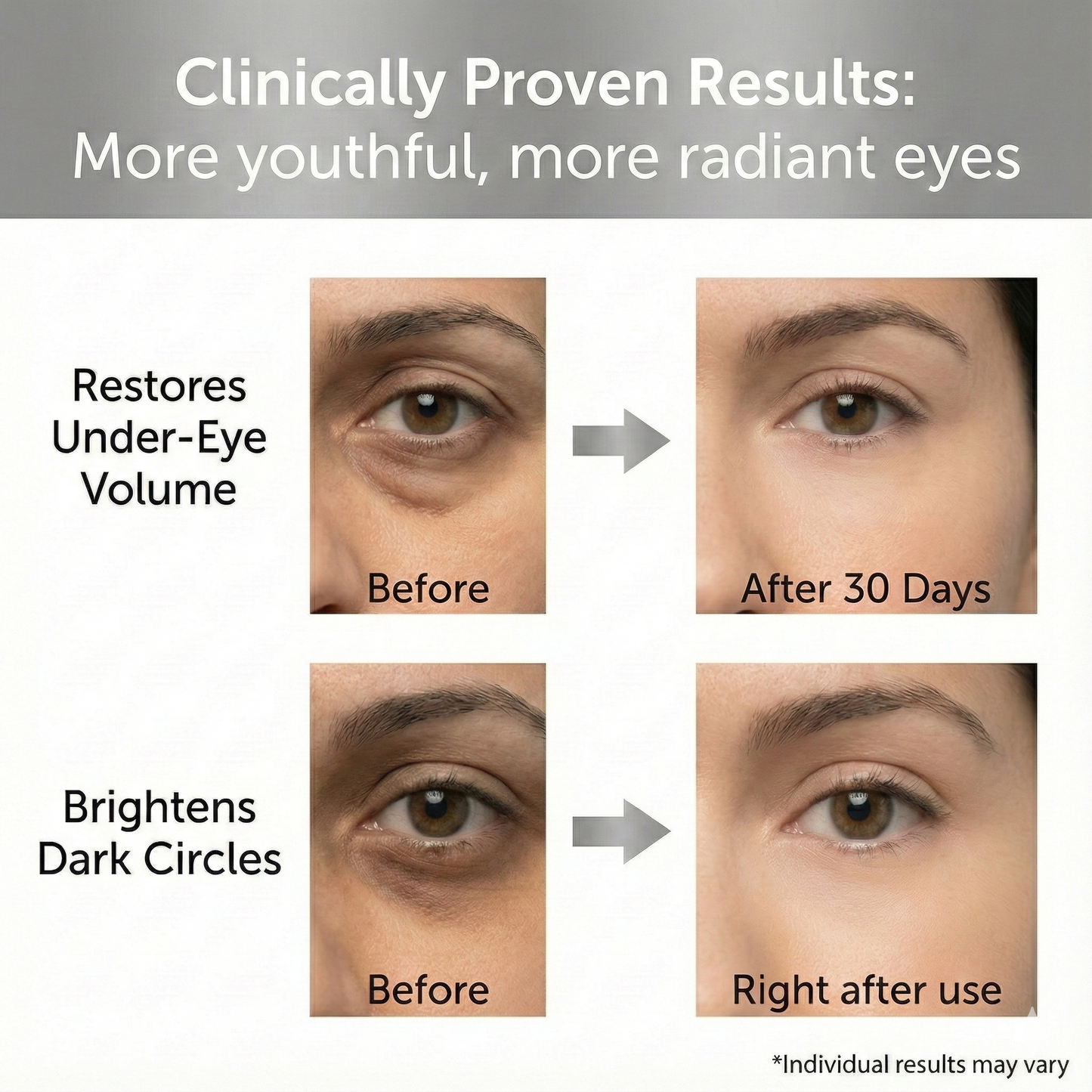 NAD+ 50 Peptide Eye Cream